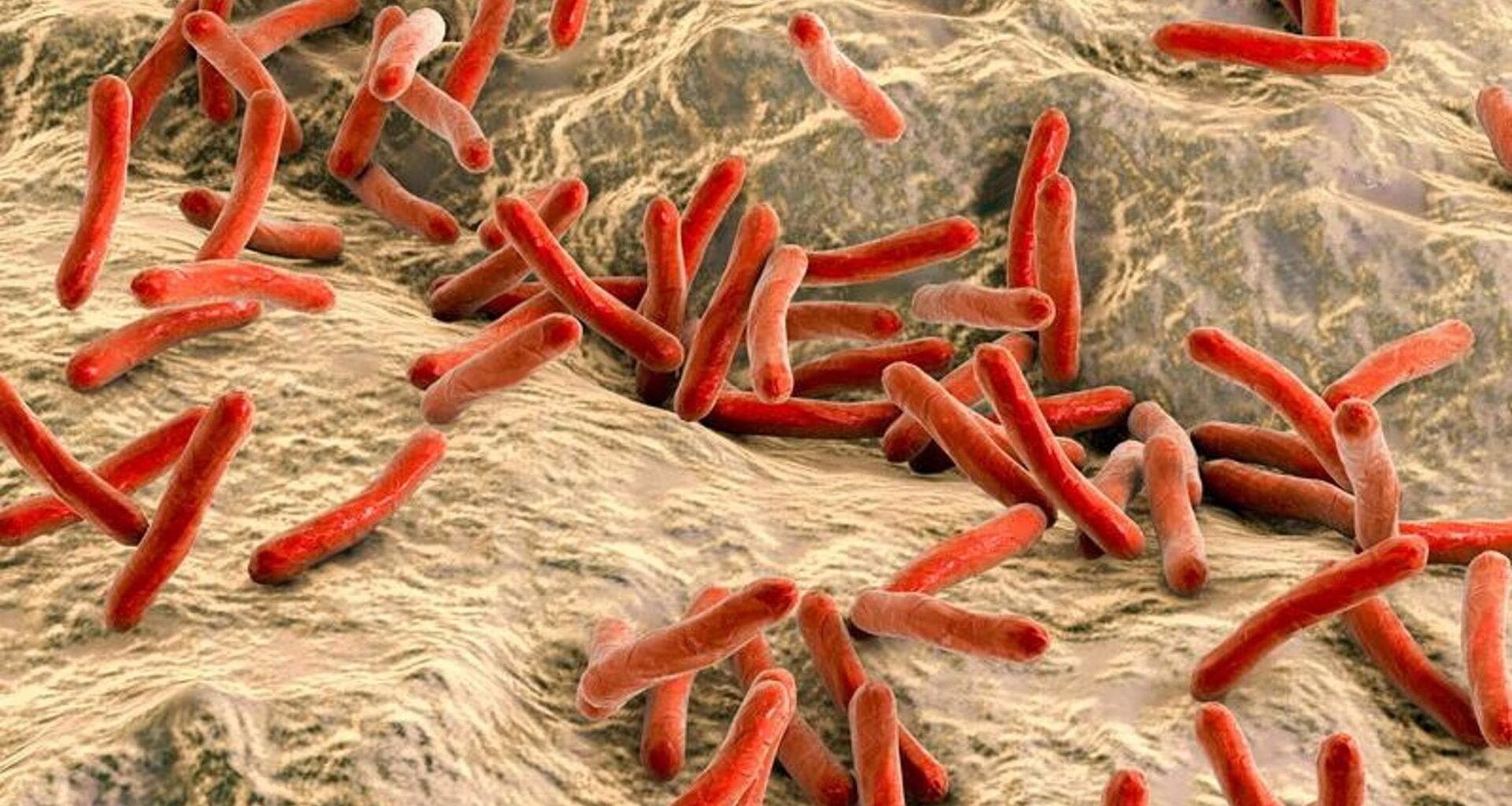 Croazia e Romania in allarme per sei casi di lebbra. La malattia in numeri minimi è anche in Italia - la Repubblica