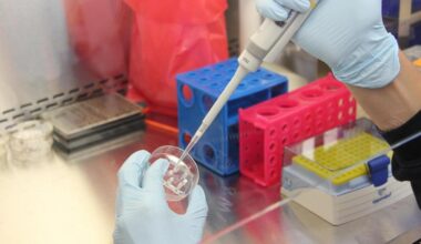 Emofilia B, primo paziente italiano curato con terapia genica