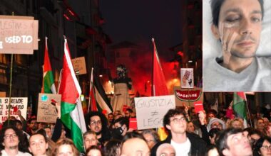 "Io sfigurato da un sasso. Neppure un messaggio dai responsabili del corteo"