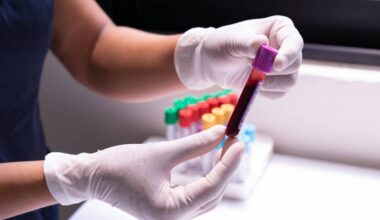 Prevenire il rischio di ictus: i valori da non superare di 3 biomarcatori chiave. Lo studio