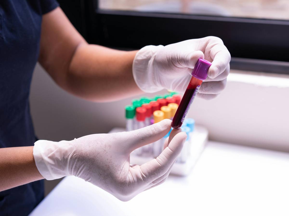 Prevenire il rischio di ictus: i valori da non superare di 3 biomarcatori chiave. Lo studio