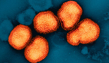 Quest’anno l’influenza è in anticipo