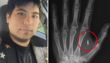 Mago si impianta un chip per fare trucchi di prestigio, ma si dimentica la password: «Tagliato fuori dalla tecnologia dentro il mio corpo»