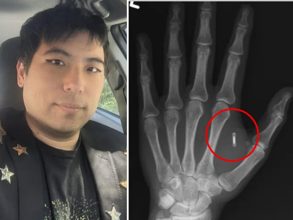 Mago si impianta un chip per fare trucchi di prestigio, ma si dimentica la password: «Tagliato fuori dalla tecnologia dentro il mio corpo»