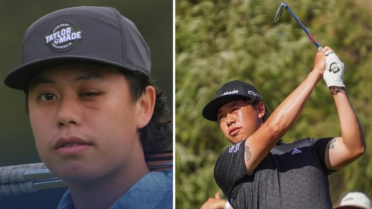 Jeffrey Guan: ha perso la vista da un occhio giocando a golf, ora sogna tra i grandi. «Una pallata mi ha mandato a terra e in terapia intensiva, sono ripartito grazie ai videogame»