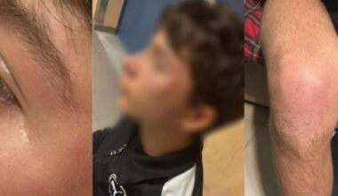 Arbitro minorenne aggredito in Puglia, l'Aia pubblica le foto