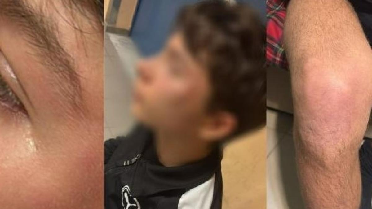 Arbitro minorenne aggredito in Puglia, l'Aia pubblica le foto