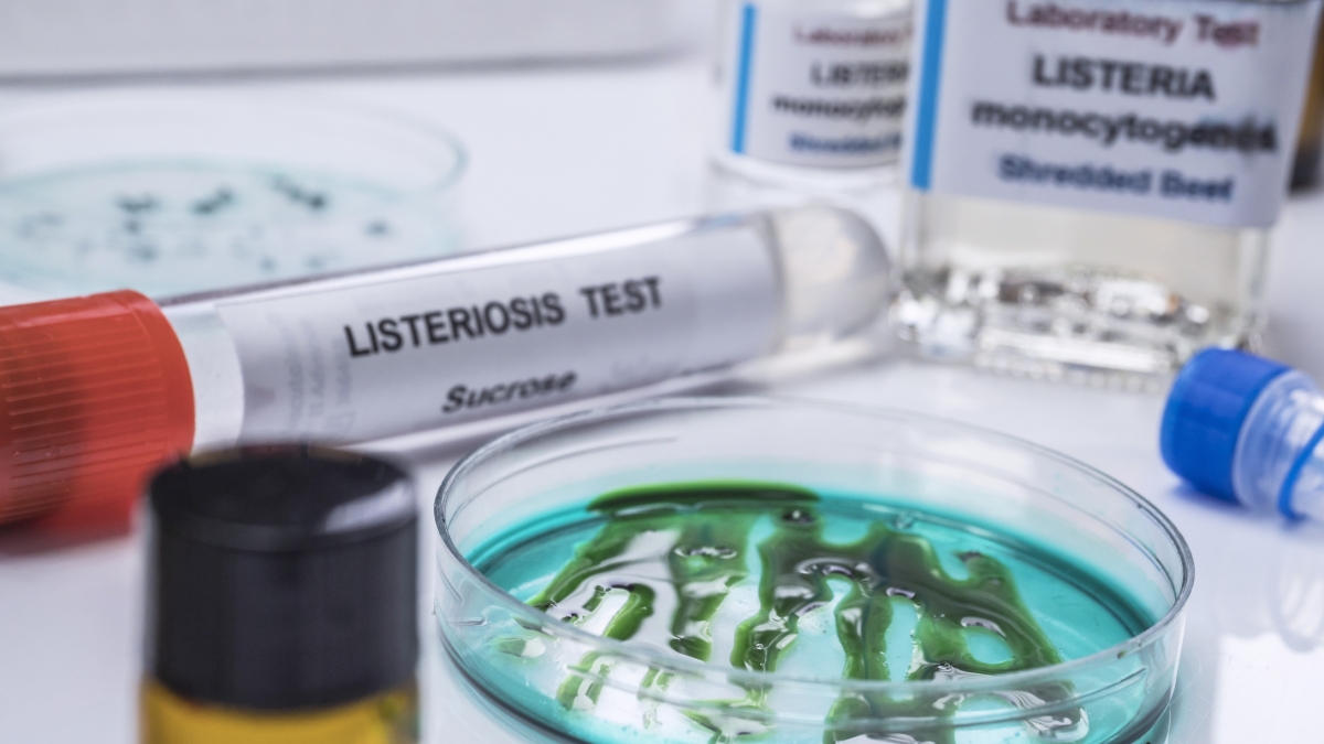 Listeria, perché in Europa aumentano i casi gravi: più anziani, cibi pronti e scarsa attenzione alle regole della conservazione