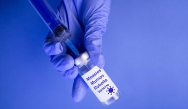 Morbillo, il rapporto dell'Istituto superiore di sanità: 485 casi da inizio anno. Copertura vaccinale insufficiente