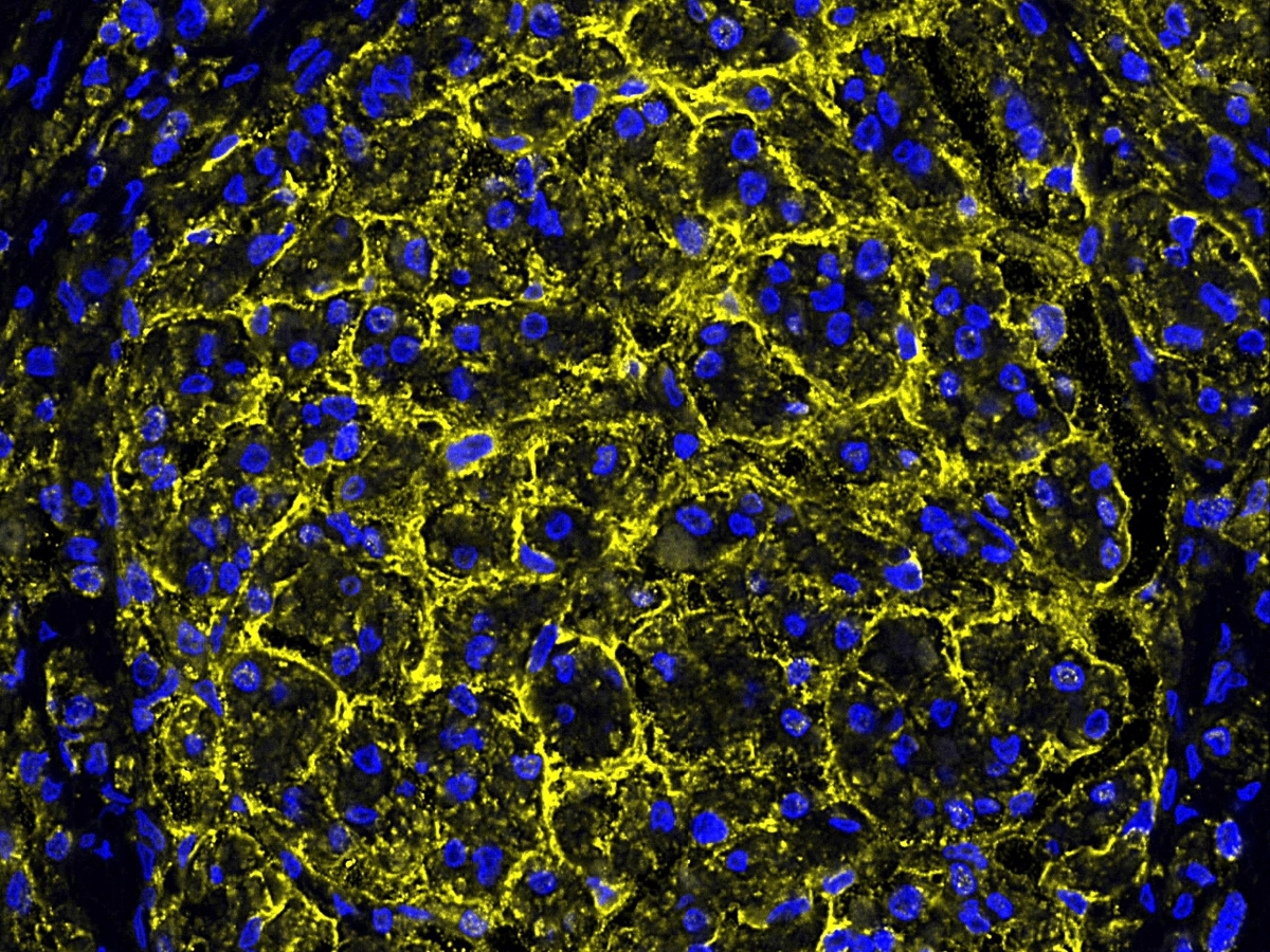 Cuore più sano e «giovane»? Il segreto potrebbe nascondersi nel nervo vago