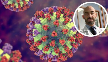 Super influenza, nuovi sintomi più duraturi. Bassetti: «Doppio picco di febbre». Quanto dura e come curare - Il Messaggero