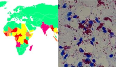 «Può arrivare anche in Italia». Sintomi e come avviene il contagio