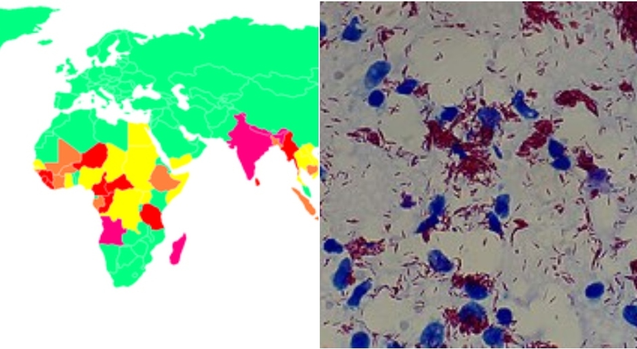 «Può arrivare anche in Italia». Sintomi e come avviene il contagio