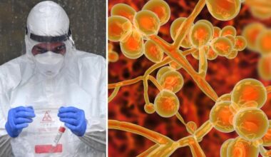 per i pazienti infetti il tasso di mortalità è del 45%. Cosa è emerso dallo studio