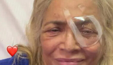 «Finiamo l'anno così». La conduttrice soffre di maculopatia: cos'è