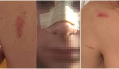 "Erano in 7. Dal locale ci hanno detto di non denunciare"