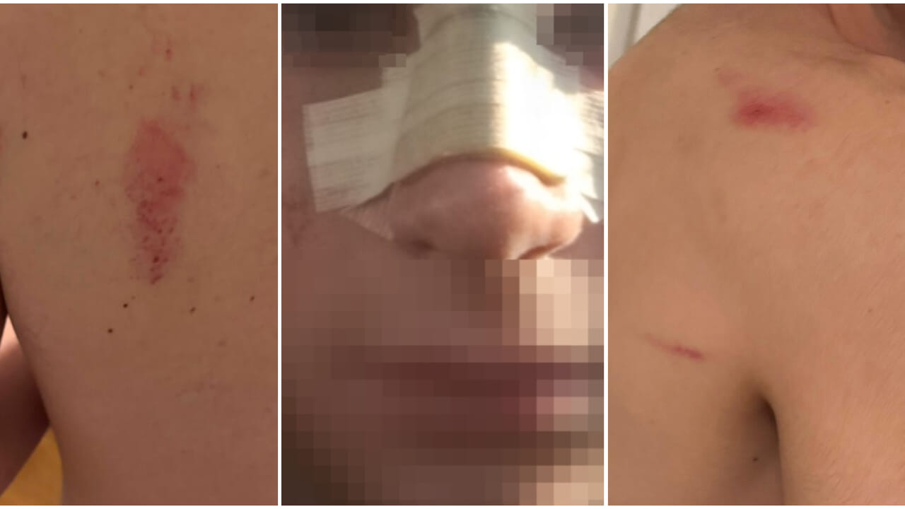 "Erano in 7. Dal locale ci hanno detto di non denunciare"