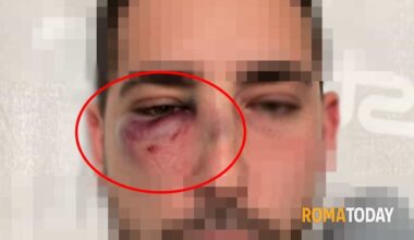 "Sono stato preso a pugni in discoteca senza motivo e nessuno del locale mi ha aiutato". Il racconto choc