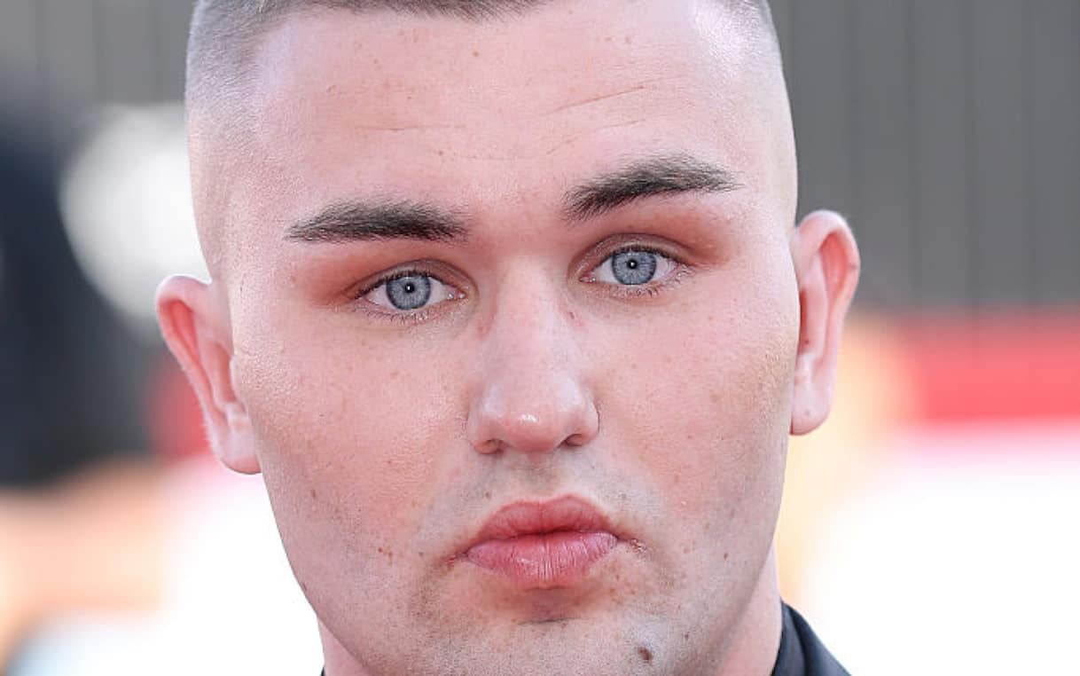 Artem Tkachuk, l'attore di Mare Fuori rompe il silenzio sul TSO I Sky TG24