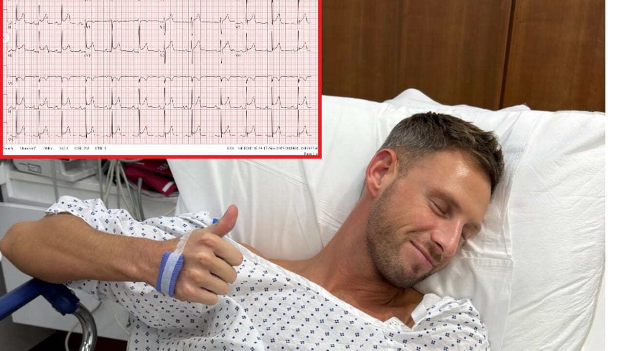 Infarto a 33 anni per la sigaretta elettronica, l'attore Fraser Olender ricoverato d'urgenza