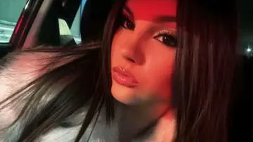 Micol morta nello schianto in motorino, l’amica torna a casa: “Avrei preferito perdere un braccio piuttosto che lei”