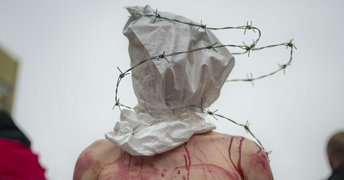 Dottor Male: sevizie sui prigionieri ucraini nella Colonia penale russa n°10