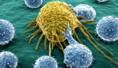 Identificato un nuovo bersaglio terapeutico per il tumore del colon-retto: lo studio Unipd