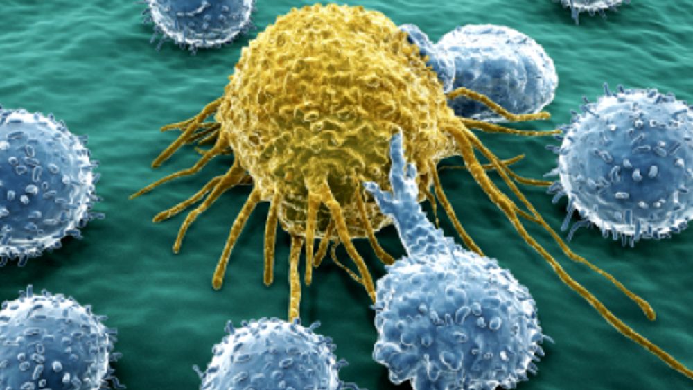 Identificato un nuovo bersaglio terapeutico per il tumore del colon-retto: lo studio Unipd