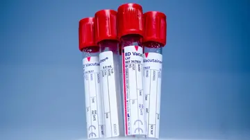 Ecco l’esame del sangue che può prevedere 14 tipi di cancro: come funziona il test