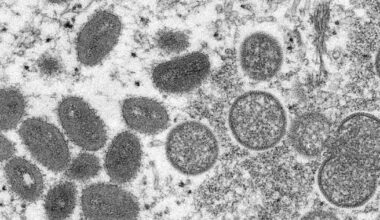 Vaiolo, virus al microscopio