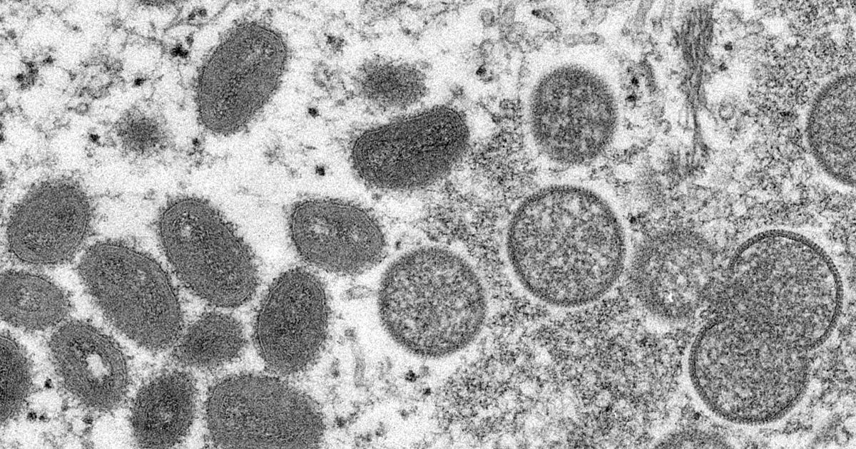 Vaiolo, virus al microscopio