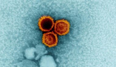 Alle origini della sclerosi multipla - RSI