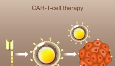 Linfomi, nuova terapia CAR-T disponibile per chi non ha benefici dalla cura di prima linea