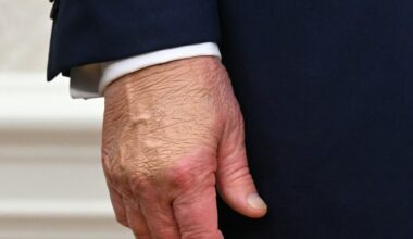 Trump: «Prendo più aspirina del dovuto, ma non la riduco, sono superstizioso. Fare esercizio? No, è noioso. E sono in perfetta salute»