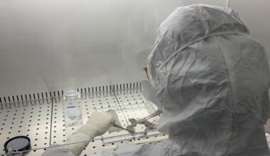 Appello dall'ospedale Niguarda (dove sono in cura gli ustionati di Crans-Montana): «Servono più donazioni di pelle»