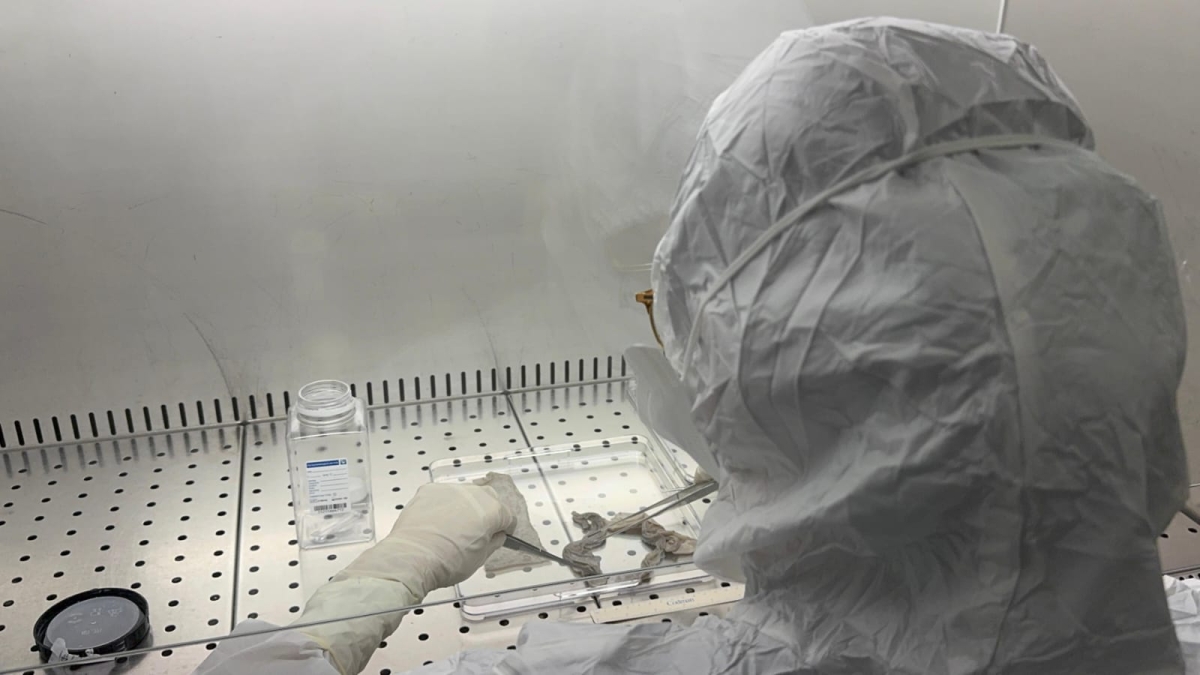 Appello dall'ospedale Niguarda (dove sono in cura gli ustionati di Crans-Montana): «Servono più donazioni di pelle»