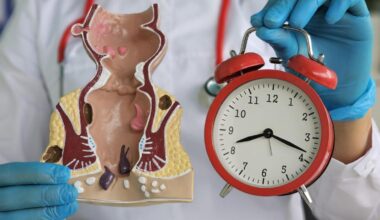 Tumore colon-retto: quanti minuti di sport per proteggersi dal cancro