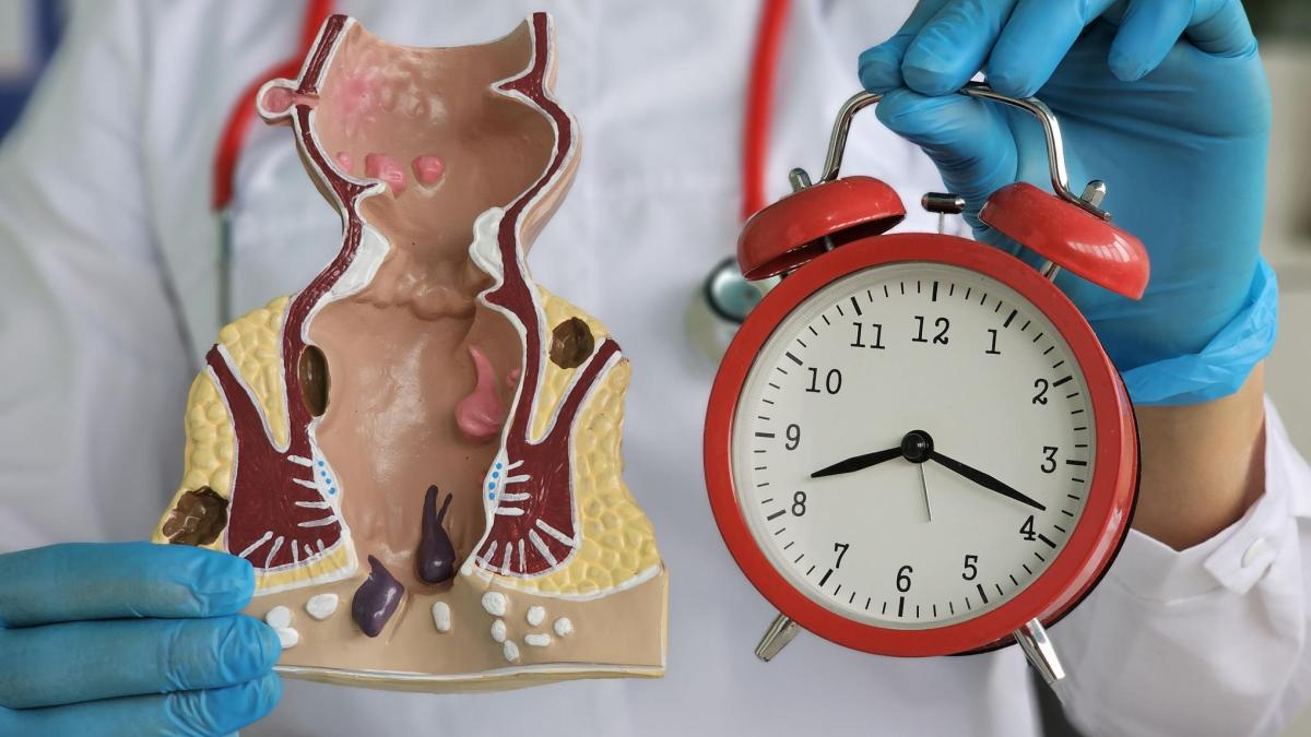 Tumore colon-retto: quanti minuti di sport per proteggersi dal cancro