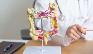 Tumore del colon-retto: negli Usa aumentano i decessi negli under 50. La situazione in Italia