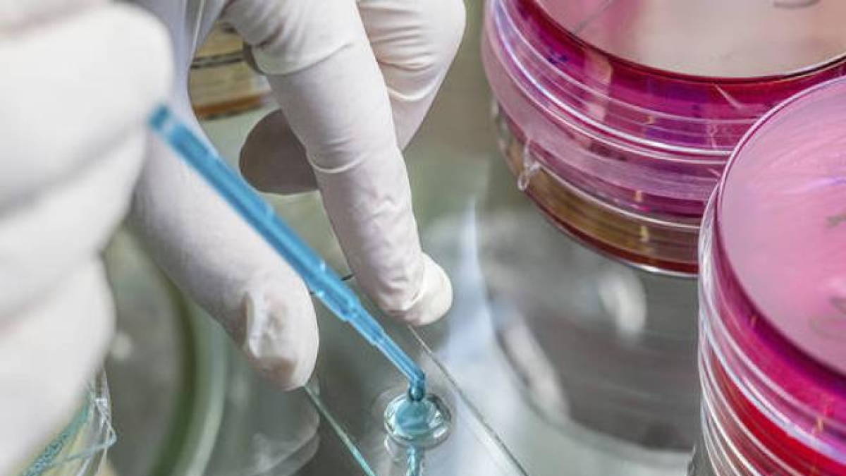 Stitichezza, secondo gli scienziati una vitamina aiuta a risolvere il problema. Ecco in quali cibi è contenuta