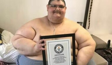 Morto l'uomo più obeso del mondo. Juan Pedro Franco era arrivato a pesare 600 chili
