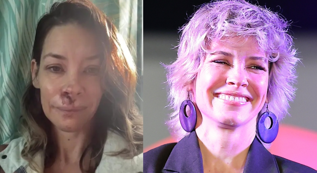 tutto è cambiato, pensavo che il mio calo cognitivo dipendesse dalla perimenopausa»