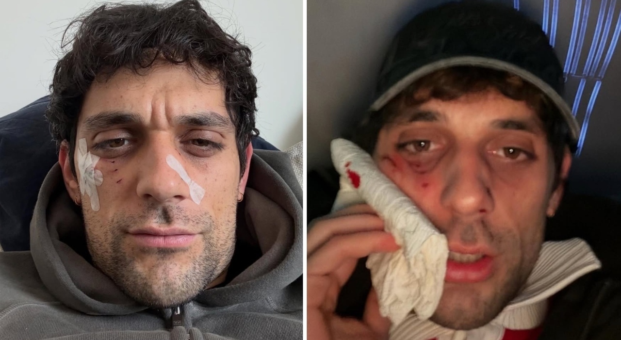 «L'abbiamo chiusa in maniera diplomatica». Cosa è successo