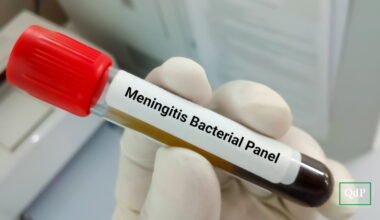 Oderzo. Caso di meningite, sedicenne ricoverato. Profilassi per 114 - Qdpnews