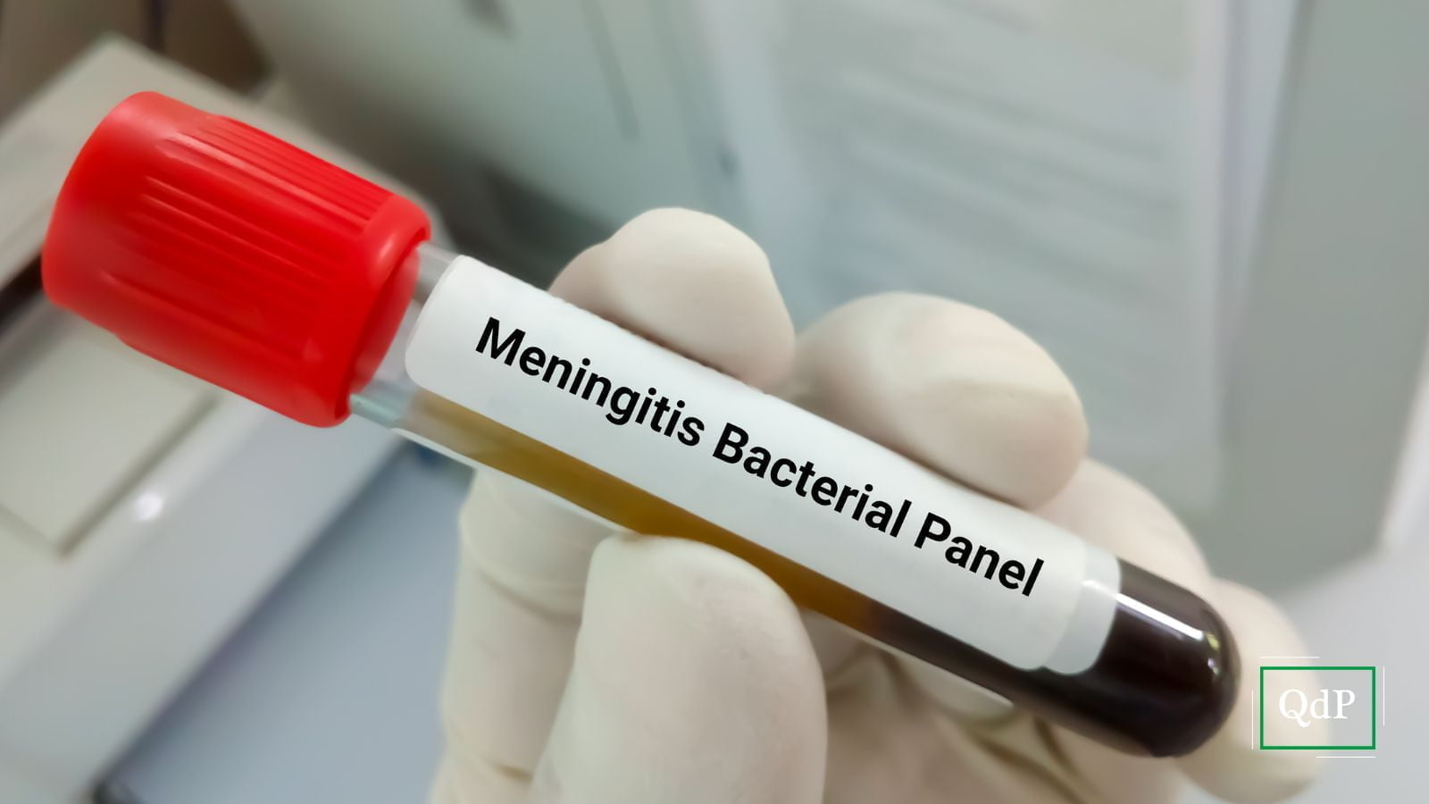 Oderzo. Caso di meningite, sedicenne ricoverato. Profilassi per 114 - Qdpnews