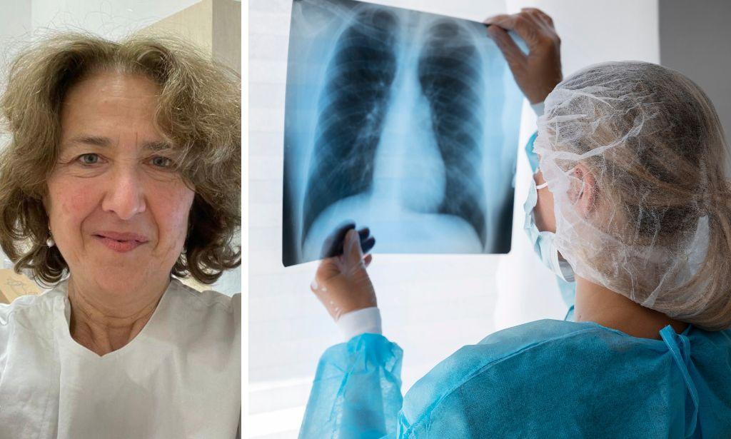 Influenza, contagi e polmoniti in aumento anche fra i giovani: la variante K e il picco in Toscana