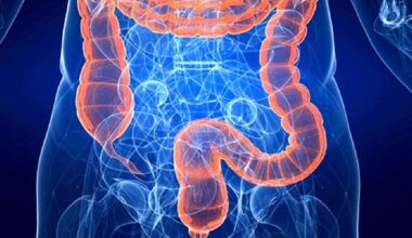 Tumore del colon-retto primo per mortalità nei giovani negli Usa. I dati italiani