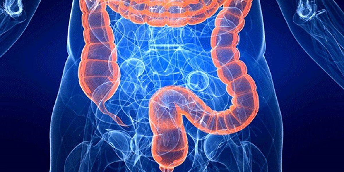 Tumore del colon-retto primo per mortalità nei giovani negli Usa. I dati italiani