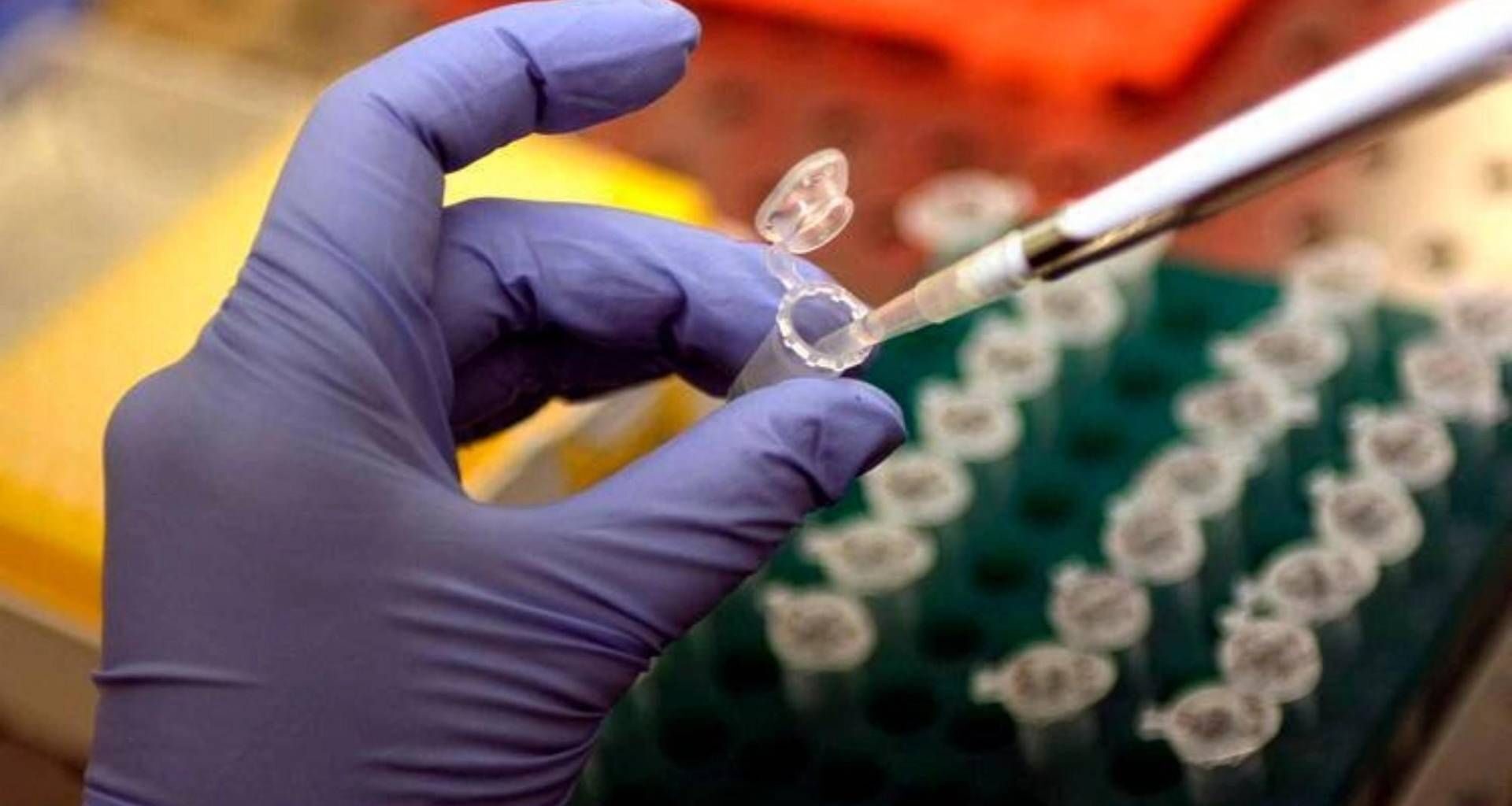 Tumore al pancreas, l'annuncio dalla Spagna: "Cancro eliminato nei topi"