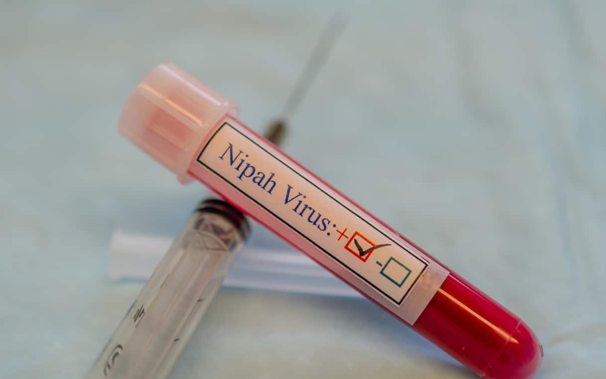 Virus Nipah, nuovi casi in India: cos'è e quali sono i sintomi dell'infezione